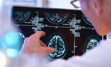 Radiologist assessing CT brain scan